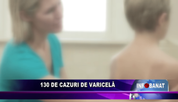 130 de cazuri de varicelă