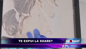 Te expui la soare?
