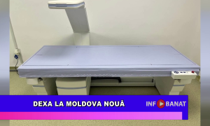 DEXA la Moldova Nouă